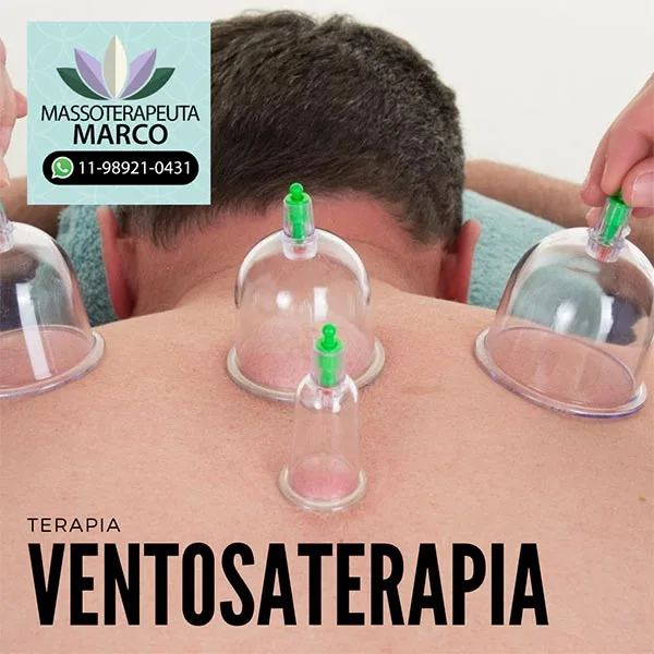 Ventosa ou ventosaterapia e seus benefícios